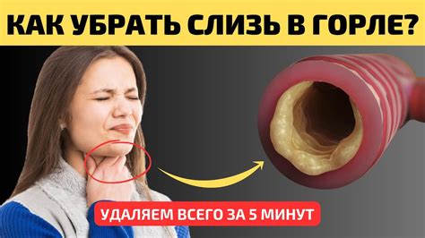 Эффективные методы избавления от слизи в горле