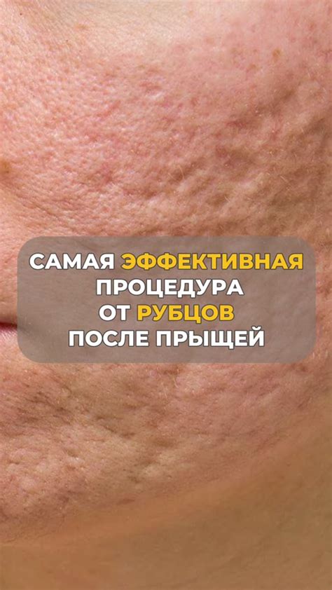 Эффективные методы избавления от темной кожи