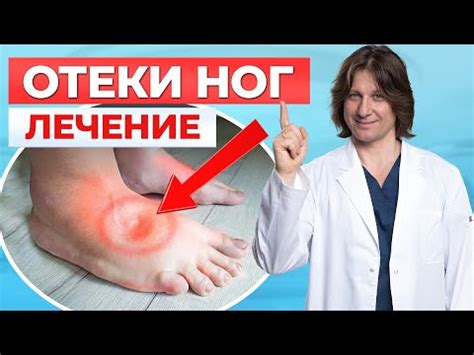 Эффективные методы лечения отека