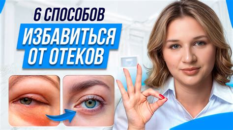 Эффективные методы лечения отеков