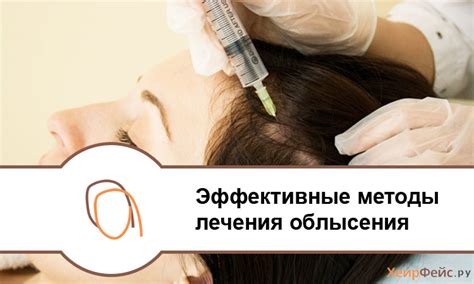 Эффективные методы предотвращения облысения