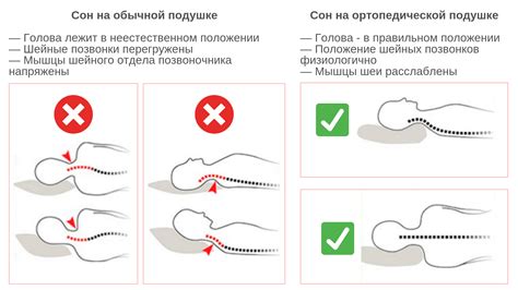 Эффективные правила сна после ушиба головы