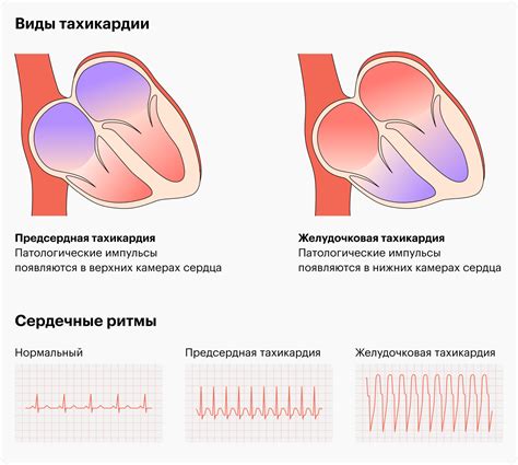  Причины прерывистого дыхания в состоянии покоя 