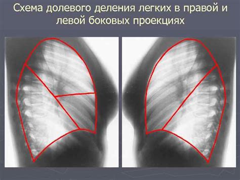  Рентгенологическое исследование органов 