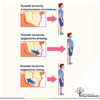  Роль питания в формировании прикуса 