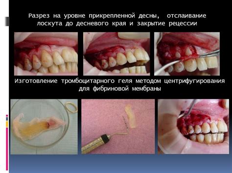 1. Охлаждение и отслаивание