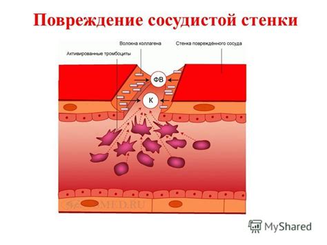 2. Повреждение сосудистой стенки